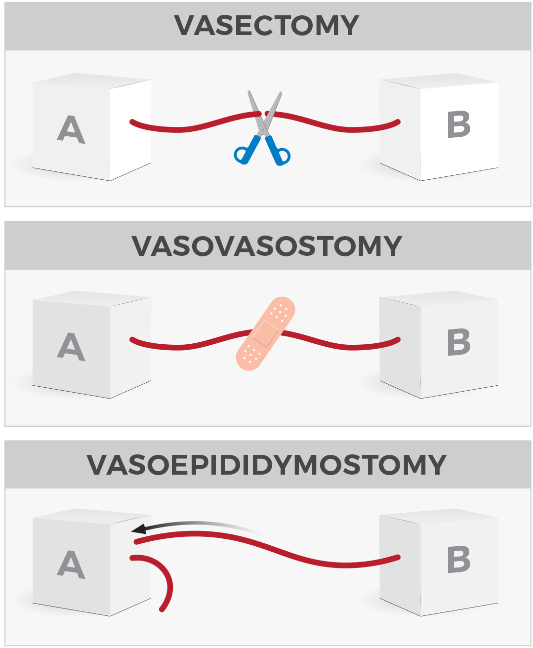 What Is The Vasectomy Reversal Success Rate 